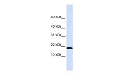 Aviva Systems Biology Corp DNAJC25-GNG10 Antibody - N-terminal region (ARP42174_P050)