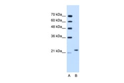 Aviva Systems Biology Corp BAG2 Antibody - C-terminal region (ARP42177_T100)