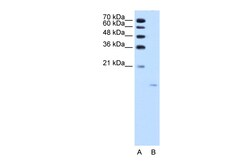 Aviva Systems Biology Corp ACP1 Antibody - N-terminal region (ARP42178_T100)