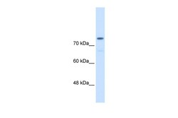Aviva Systems Biology Corp ACTN4 Antibody - C-terminal region (ARP42203_P050)