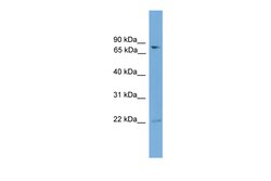 Aviva Systems Biology Corp GFPT2 Antibody - N-terminal region (ARP42214_P050)