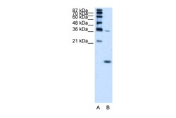 Aviva Systems Biology Corp HBZ Antibody - N-terminal region (ARP42231_T100)