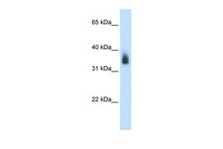 Aviva Systems Biology Corp MAGEA8 Antibody - N-terminal region (ARP42233_P050)