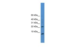 Aviva Systems Biology Corp PSCA Antibody - C-terminal region (ARP42250_P050)