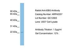 Aviva Systems Biology Corp EBI3 Antibody - middle region (ARP42257_P050)