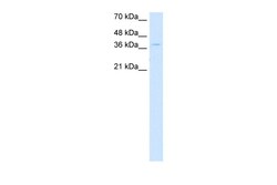 Aviva Systems Biology Corp CTDSPL Antibody - N-terminal region (ARP42261_P050)