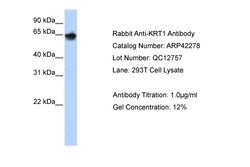 Aviva Systems Biology Corp KRT1 Antibody - middle region (ARP42278_P050)