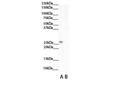 Aviva Systems Biology Corp NNMT Antibody - N-terminal region (ARP42281_T100)