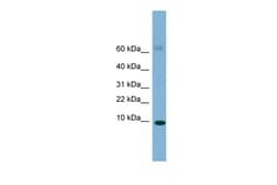 Aviva Systems Biology Corp SAA4 Antibody - middle region (ARP42301_P050)