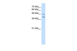 Aviva Systems Biology Corp PSG1 Antibody - C-terminal region (ARP42326_T100)
