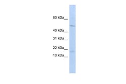 Aviva Systems Biology Corp VPREB1 Antibody - middle region (ARP42346_P050)