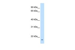 Aviva Systems Biology Corp FAM107A Antibody - middle region (ARP42348_T100)