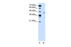 Aviva Systems Biology Corp GPR161 Antibody - middle region (ARP42354_P050)