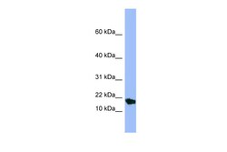 Aviva Systems Biology Corp SMR3A Antibody - middle region (ARP42363_P050)