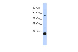Aviva Systems Biology Corp TAC3 Antibody - middle region (ARP42372_P050)