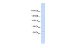 Aviva Systems Biology Corp LGALS13 ANTIBODY 50UG/50UL, Quantity: Each of