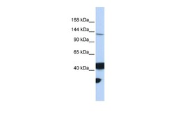 Aviva Systems Biology Corp MLH3 Antibody - middle region (ARP42403_P050)