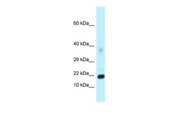 Aviva Systems Biology Corp Dkk4 Antibody - C-terminal region (ARP42406_P050)