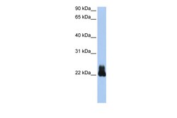 Aviva Systems Biology Corp RHOD Antibody - N-terminal region (ARP42413_P050)