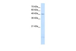 Aviva Systems Biology Corp PSD3 Antibody - middle region (ARP42443_T100)