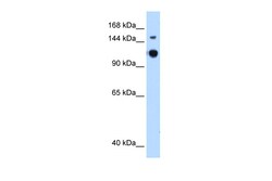 Aviva Systems Biology Corp GAPVD1 Antibody - N-terminal region (ARP42451_P050)