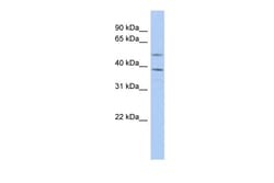 Aviva Systems Biology Corp TENT5A Antibody - N-terminal region (ARP42484_P050)