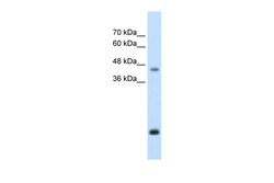 Aviva Systems Biology Corp ASPN Antibody - middle region (ARP42487_T100)