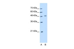 Aviva Systems Biology Corp KRT20 Antibody - middle region (ARP42529_T100)