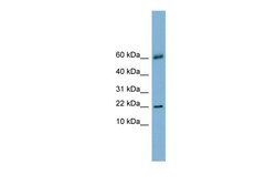 Aviva Systems Biology Corp LGALS14 Antibody - N-terminal region (ARP42549_P050)