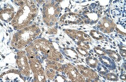 Aviva Systems Biology Corp C21orf7 Antibody - C-terminal region (ARP42552_T100)