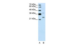 Aviva Systems Biology Corp DCUN1D1 Antibody - N-terminal region (ARP42570_P050)