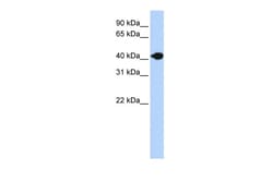 Aviva Systems Biology Corp DNASE2B Antibody - N-terminal region (ARP42593_P050)