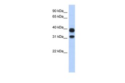 Aviva Systems Biology Corp CHIA Antibody - N-terminal region (ARP42601_P050)