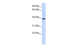 Aviva Systems Biology Corp CHIA Antibody - middle region (ARP42602_P050)