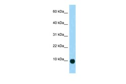 Aviva Systems Biology Corp Sct Antibody - N-terminal region (ARP42604_P050)