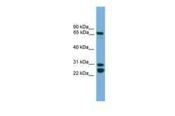 Aviva Systems Biology Corp DNAI2 Antibody - N-terminal region (ARP42619_P050)