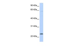 Aviva Systems Biology Corp CHAC1 Antibody - C-terminal region (ARP42623_P050)