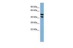Aviva Systems Biology Corp FLJ14213 Antibody - middle region (ARP42638_P050)