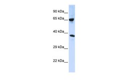 Aviva Systems Biology Corp C6orf134 Antibody - middle region (ARP42643_P050)