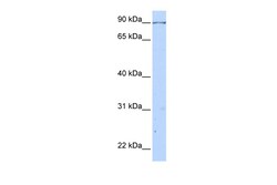 Aviva Systems Biology Corp CALD1 Antibody - C-terminal region (ARP42684_P050)