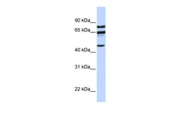 Aviva Systems Biology Corp PPP4R2 Antibody - C-terminal region (ARP42719_P050)