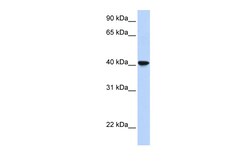 Aviva Systems Biology Corp SIGLEC6 Antibody - middle region (ARP42739_P050)