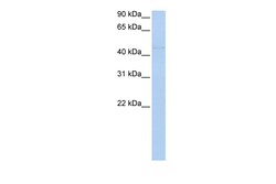 Aviva Systems Biology Corp NR2F1 Antibody - N-terminal region (ARP42799_P050)