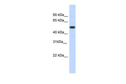 Aviva Systems Biology Corp IRX3 Antibody - N-terminal region (ARP42800_P050)