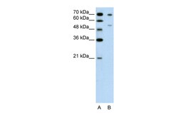 Aviva Systems Biology Corp FOXB2 Antibody - N-terminal region (ARP42814_P050)