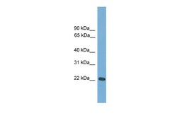 Aviva Systems Biology Corp Rgs1 Antibody - N-terminal region (ARP42843_P050)