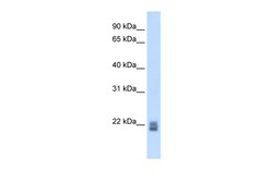 Aviva Systems Biology Corp Rgs1 Antibody - N-terminal region (ARP42844_T100)