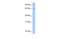 Aviva Systems Biology Corp OCLN Antibody - N-terminal region (ARP42888_T100)