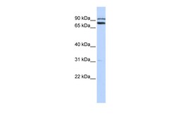 Aviva Systems Biology Corp TRIM67 Antibody - C-terminal region (ARP42961_P050)