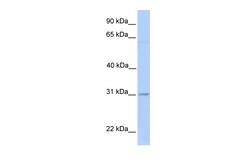 Aviva Systems Biology Corp MARCH2 Antibody - middle region (ARP42966_P050)